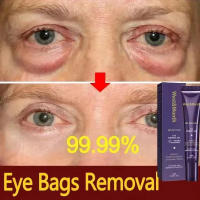 Crema Instantánea para Ojos con Retinol Reducción de Arrugas, Reafirmación de Piel, Adiós a las Ojeras, Ilumina tu Mirada - details 0