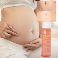 Los aceites esenciales biológicos suaves y no irritantes previenen y desvanecen las cicatrices de la obesidad durante el embarazo - details 3