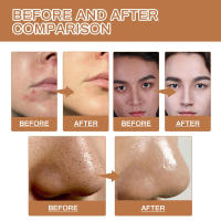 Limpiador facial EAST MOON para hombres que limpia profundamente los poros, la queratina, controla la grasa, ilumina, hidrata y repara la piel opaca - details 8