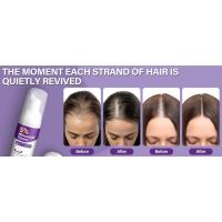 minixodoxil for women