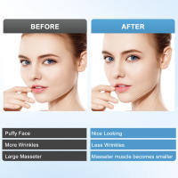 Masajeador eléctrico para dar forma a la cara en V, mascarilla para la barbilla, dispositivo de elevación facial ajustable para papada, masajeador facial de fototerapia rojo y azul, 6 modos - details 4