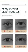 Sérum para los Ojos de Retinol SADOER Adiós a las Ojeras, Hidratación y Reafirmación - details 1