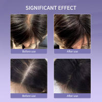 Masajeador eléctrico de cabeza, peine de crecimiento del cabello, láser infrarrojo, cuidado del cabello, terapia de luz roja, cepillo anticaída, vibración de alta frecuencia - details 2