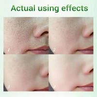 Crema Reductora de Poros de Ácido Salicílico Eliminación Rápida de Pimientas Piel Suave y Lisa - details 2