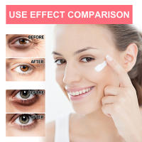 Crema para los Ojos con Retinol Anti-envejecimiento, Firmante, Iluminadora y Hidratante - details 3