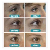 Crema para los Ojos de Retinol Anti-arrugas, Reduce Ojeras, Hidratante - details 5
