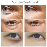 Esencia para ojos de 60 segundos, eliminador de arrugas y envejecimiento, suero Facial, crema para el cuidado de la piel, reafirmante, ojeras, cosmético coreano - details 5