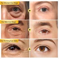 Crema de eliminación instantánea de bolsas para ojos, Retinol, antiarrugas, reafirmante, desvanecimiento de la piel, líneas finas, antihinchazón de ojeras, ilumina el cuidado de los ojos - details 1