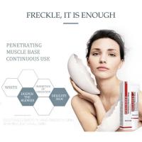 Potente crema blanqueadora que elimina manchas, ilumina la piel, elimina rápidamente la pigmentación de melanina, melasma, manchas oscuras, cuidado de la piel coreano - details 4