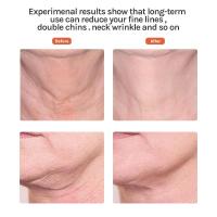Herramienta de masaje facial con luz roja, masajeador facial para el cuidado de la piel con LED calentado y tensores de vibración y rejuvenecimiento para rostro y cuello - details 5
