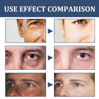 Hidratante facial para hombre 6 en 1: crema facial antienvejecimiento - Tratamiento de bolsas para los ojos - Cuidado de la piel para hombres 50 ml - details 8
