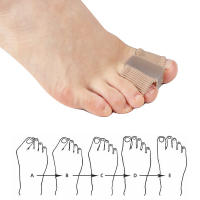 5Pcs Almohadillas de Gel de Silicona para Pies Corrector de Hallux Valgus Ajustador de Dedos - details 2