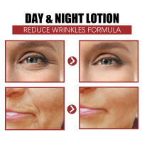 Retinol-Juego de suero Facial eliminador de arrugas, crema antienvejecimiento reafirmante instantánea, blanqueamiento de líneas finas, cuidado hidratante de la piel - details 12