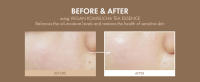 Before & After using Vegan Kombucha Tea Essence