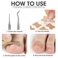 Pegatinas de corrección de uñas encarnadas, parches correctores para tratamiento de paroniquia, herramientas de pedicura, 10/20 piezas - details 5