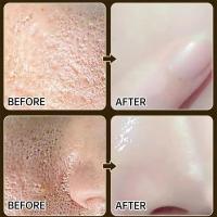 Crema Reductora de Poros de Ácido Salicílico Adiós a los Pulgares, Reparación de Piel, Estiramiento - details 4