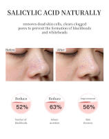 Espuma limpiadora facial con 0.5% de salicílico, control de grasa, refrescante, para piel sensible y propensa al acné, reparadora. - details 8