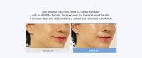 New_Gentle Exfoliator