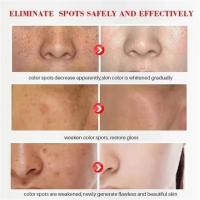 Suero Blanqueador Corrector de Manchas Dark Spots Iluminador de Piel Cuidado de Belleza Coreano - details 4