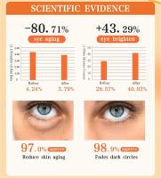 Crema de eliminación instantánea de bolsas para ojos, Retinol, antiarrugas, reafirmante, desvanecimiento de la piel, líneas finas, antihinchazón de ojeras, ilumina el cuidado de los ojos - details 2