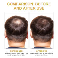 Romero para el cuidado de la limpieza del cuero cabelludo, reparación suave y esponjosa, fijación de furia seca y aceite esencial reafirmante para el cabello - details 5