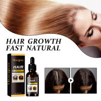 La esencia de jengibre mejora el aceite esencial para el cuidado del cabello seco, peludo, hidratante, suave, esponjoso y brillante - details 6