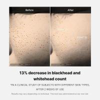 Suero facial reafirmante Medicube Zero Pore para tensar la piel con 15.2% AHA+BHA+PHA y 2% Niacinamida - details 3