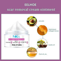 Crema para cicatrices aclara las estrías, los bultos de grasa y las cicatrices, hidratando la piel. - details 1