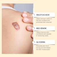 El veneno de abeja limpia y cuida suavemente la piel, mientras que la crema para el cuidado de la piel corporal Kayu - details 10
