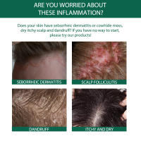 Cuero cabelludo limpieza profunda folículos caspa reparación cabello suavizante esencia de cuidado - details 6