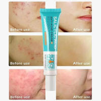 Crema Reparadora de Acné Efectiva Control de Aceite de Poros, Hidratación, Limpieza Profunda - details 17
