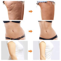 Masajeador eléctrico para adelgazar, máquina de Fitness para el hogar, moldeador de brazos, piernas, vientre, liposucción para pérdida de peso, quemador de grasa, VE Sport - details 4
