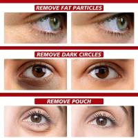 Crema para ojos eliminadora de gránulos de grasa, crema firme antiinflamatoria, Reduce las ojeras, desvanece las líneas finas, barrera de reparación Sk - details 0