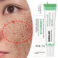 Crema Reductora de Poros de Ácido Salicílico Eliminación Rápida de Pimientas Piel Suave y Lisa - details 18