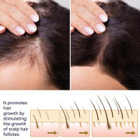 Spray hidratante para el cuidado del cabello, seco y rizado, fortalecedor y mejorador - details 6