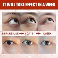 Sérum de Eliminación de Gránulos de Ojo de 30ml Efectivo contra Partículas, Mejora el Enrojecimiento, Cuidado de la Piel de Belleza - details 4