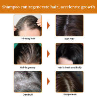 Champú de arroz para limpieza profunda, hidratación densa, fijación de raíces y cuidado del cabello. - details 5