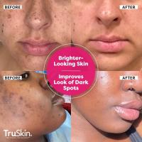 TruSkin Super suero de vitamina C - niacinamida, retinol, ácido hialurónico y salicílico - suero antienvejecimiento todo en uno para la cara - mejora la apariencia de las manchas oscuras, firmeza para una piel más brillante, 2 fl oz - details 1