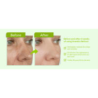 Enaskin Naturals Retinol Serum Face: relleno antiarrugas para arrugas profundas, manchas oscuras y reafirmante del cuello con ácido hialurónico, 1 - details 3
