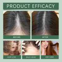 Spray fuerte, hermoso, nutritivo, hidratante y que mejora la calidad del cabello, líquido para el cuidado del cuero cabelludo - details 8