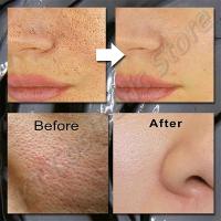Mascarilla de Lodo Volcánico Limpieza Profunda de Poros, Control de Aceite, Hidratación, Iluminación de Piel Suave Herramientas de Cuidado de la Piel Facial - details 5