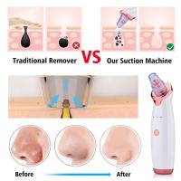 Limpiador eléctrico de poros al vacío, eliminador de espinillas, puntos negros, acné, nariz, herramientas de limpieza Facial - details 7