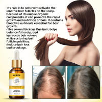 Ginger Care Raíces suaves, nutritivas e hidratantes, nutritivo, cuidado del cabello, aceite esencial para masaje del cuero cabelludo - details 4
