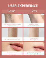 Vancostar-depiladora láser IPL para hombres y mujeres, fotodepiladora IPL para uso doméstico, dispositivo Flash, 999900 - details 8