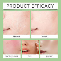 Esencia Hidratante de Ácido Hialurónico Calmante (verde claro), hidratación profunda, reafirmante y mejora la piel del rostro. - details 9