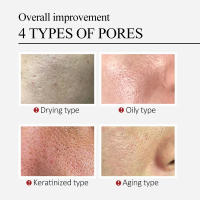 Crema Reductora de Poros de Ácido Salicílico Eliminación Rápida de Pimientas Piel Suave y Lisa - details 3