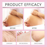Aceite Materno Postparto: cuidado suave y nutritivo para mejorar la calidad de la piel - details 7