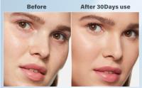Masajeador Facial Eléctrico Antiarrugas Masaje, Aparato reafirmante que calienta y enfría, herramienta facial ligera con vibración, kit eléctrico para el cuidado de la piel, masajeador facial con 8-21°C frío, 38-47°C calor - details 2