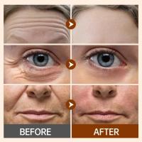 Crema Anti-Arrugas Retinol Blanqueo Inicial de Piel de Cara y Ojos Adiós a las Manchas Dark - details 1