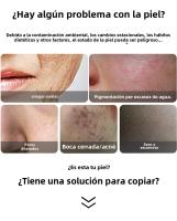 Mini Instrumento Portátil de Belleza Vibración de Alta Calidad para Reafirmar y Estilizar la Piel - details 4